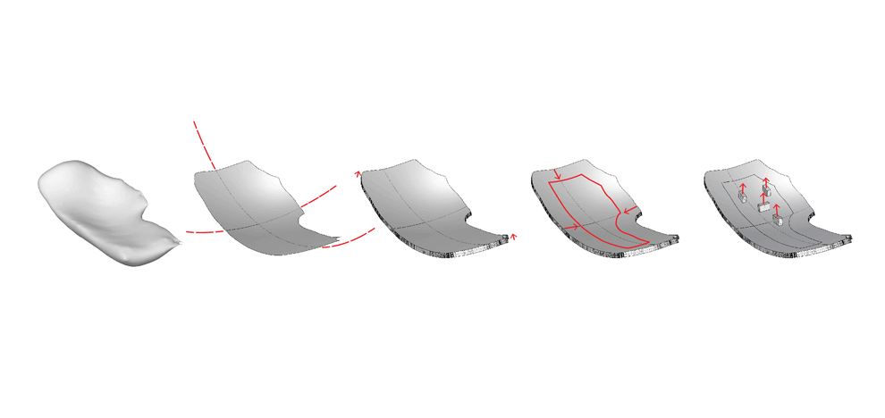 3d-printing-intraoperative-neuronavigation-tailoring-skull-base-reconstruction-after-extended-endoscopic-endonasal-surgery-1